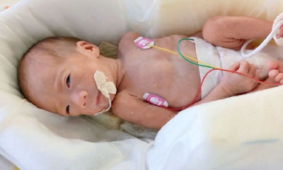 写真：病院の新生児集中治療室でドナーミルクを与えられている赤ちゃん（日本財団母乳バンク提供）
