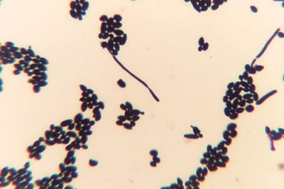写真：実験に使ったものと同種のカンジダ菌（東北大大学院歯学研究科提供）