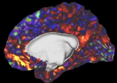写真：脳機能を捉える「機能的磁気共鳴画像装置（ｆＭＲＩ）」で撮影した画像（国際電気通信基礎技術研究所提供）