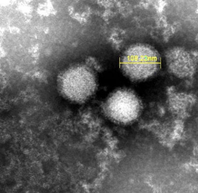 写真：「重症熱性血小板減少症候群」を引き起こすウイルスの電子顕微鏡写真（国立健康危機管理研究機構提供）