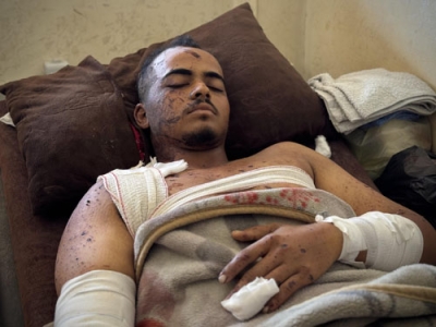 写真：イスラエルによる病院攻撃で負傷し、治療を受けるパレスチナのテレビカメラマン＝２６日、パレスチナ自治区ガザ（ゲッティ＝共同）