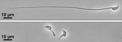写真：マウスの精子の顕微鏡画像。タンパク質「ＣＦＡＰ９１」を作る遺伝子を欠損させた精子（下）は、べん毛の形成がうまくいかず泳げなくなった